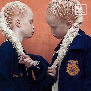 These albino twins are beautiful! | In The Know Beauty