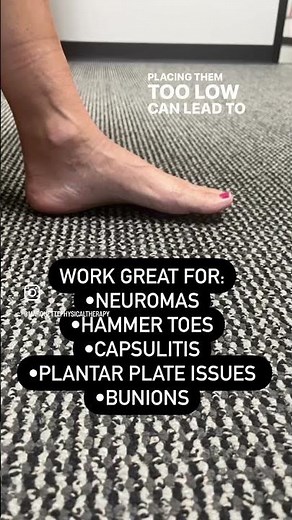 Metatarsal Pad placement for neuromas