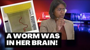 1.9K views · 37 reactions | Insane Reason Why a Doctor Freaked Out The patient didn't know what was making her so sick. | The News Junkie | Facebook