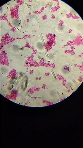 🔬Fungi Yeast Budding Under Microscope | Asexual Reproduction | Biology Short