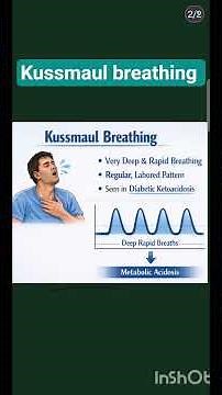 Kussmaul breathing l breathing pattern l Respiration 🫁 l physiology l MBBS l diabetic ketoacidosis