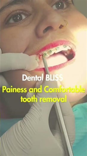 Painless extraction? Yes, it’s real! #PainlessExtraction #ToothRemoval #braces #HealthySmile #ortho
