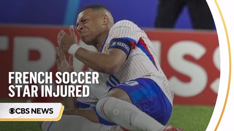 France's Kylian Mbappé sufferers broken nose in Euro 2024 match