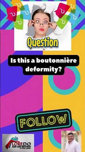 Is this a boutonniere deformity?