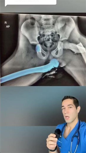 Why you should NEVER put your feet on the dashboard