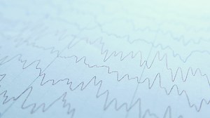 Detail shot of cardio diagram