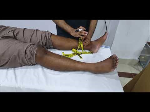 Skill Station: Below Knee Amputation