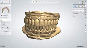 NEW with Dental System 2018: Multi-Scan handling Access an unlimited option to import multiple scans into any workflow for enhanced control and more creative freedom. Read more: http://ow.ly/TpVu30ktwaW | 3Shape