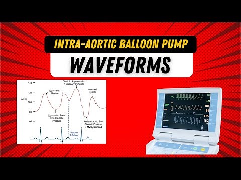 Intra Aortic Balloon Pump Waveform: IABP Waveform for Nurses