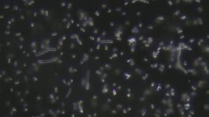 Probióticos: Lactobacillus acidophilus y Bifodobacterium bifidum