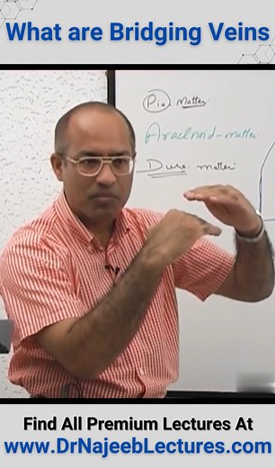 What Are Bridging Veins. The bridging vein (BV) is a connecting vessel that drains venous blood flow from the brain's surface to the surrounding dural sinus. There are many BVs around the major dural sinuses, such as the superior sagittal and transverse sinuses. | Dr. Najeeb