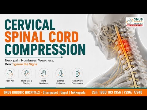 Cervical Spinal Cord Compression Explained _ Neck Pain, Weakness & Warning Signs