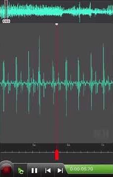 早い不整脈 Irregular heartbeat