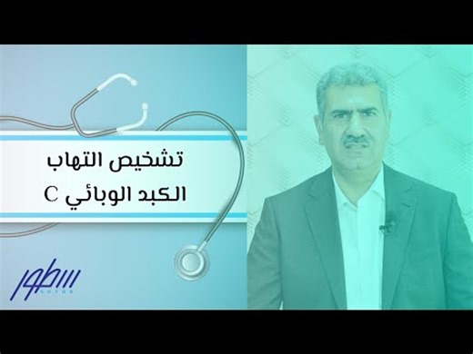 تشخيص التهاب الكبد الوبائي C