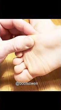 Splinter in foot! Quick, easy way to remove a thorn, stone or splinter in your foot