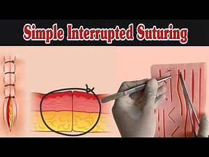 Simple Interrupted Suturing | Simple Suture Procedure