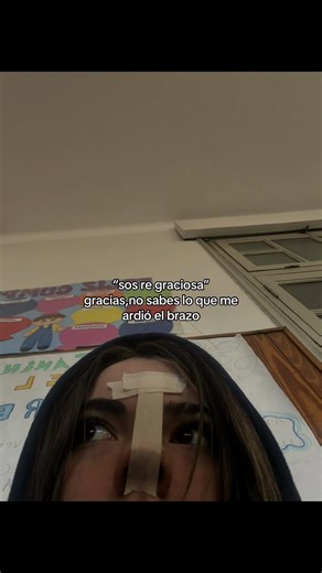 Sos re graciosa, me ardió el brazo