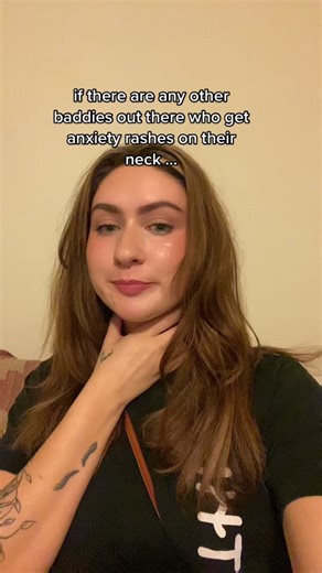 Dealing with Anxiety Rashes on Your Neck