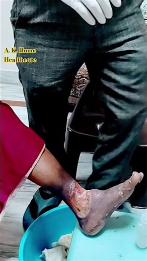 Proper Leg Dressing Technique | Leg Wound Dressing | Medical || #shorts