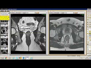 Pelvic Floor Anatomy & Imaging | Part 3
