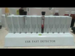 تحليل سرعة الترسيب ESR وطريقة استخدام Fast detector ESR - كورس التحاليل الطبية