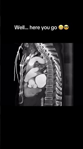 4d ct scan #medical #health #heart #ai #ctscan #lungs #anatomy #medschool #medicalimaging #rare