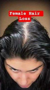 Female Hair Loss Treatment | Keraglo Eva Tablet Review #shorts #hairloss #ytshorts