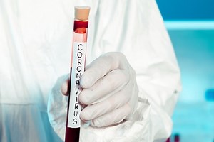 Test COVID-19: cuándo hacerlo, tipos y resultados