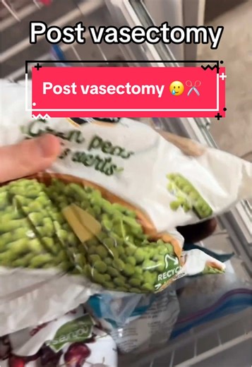 Post Vasectomy Experience: What to Expect After Surgery