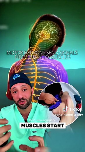 Spinal muscular atrophy type 2 is a genetic disease where motor neurons slowly fail. Kids are usually diagnosed in early childhood. They can sit but often cannot walk. Intelligence is normal. The problem is muscle weakness not the brain. Early diagnosis and modern therapies are changing outcomes but it is still a lifelong neuromuscular disease. #genetic #medical #science #stem #interesting