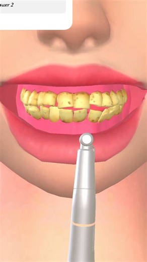 asmr teeth cleaning