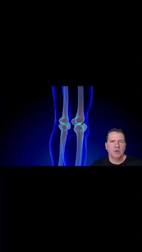 Hydrogel - What it is and how it works in the knee