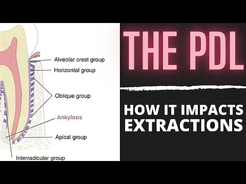 Understanding The Periodontal Ligament | OnlineExodontia.com