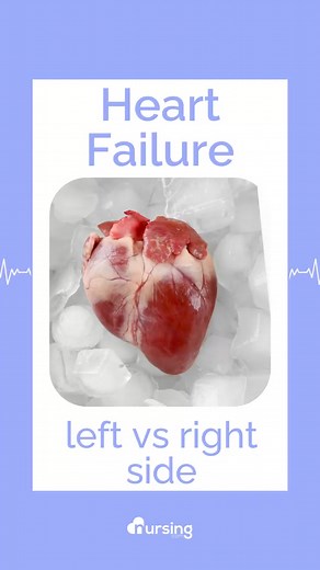 2.7K views · 22 reactions | 變 Left vs. Right-Sided Heart Failure:...