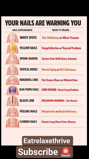 “Don’t Ignore These Nail Changes – They Signal Disease” #nails #care #health