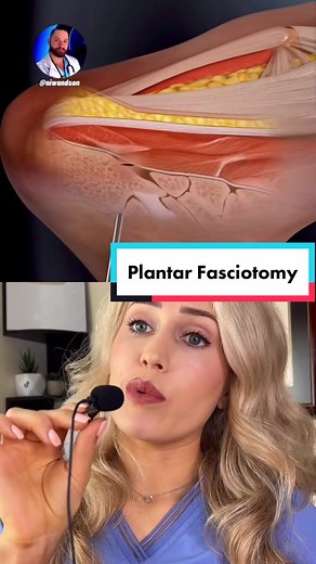 Endoscopic Plantar Fascia Release Surgery Explained