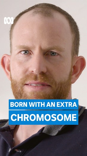 What is it like living with 47,XXY? #ListenUp #47XXY #Health #MensHealthWeek | ABC Science