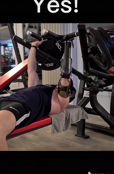 Transforming Fitness with Arm Prosthesis Workouts