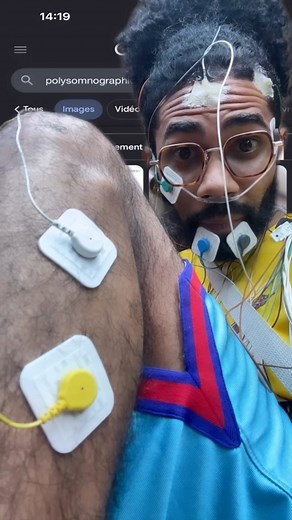 #Polysomnography | Taïkun Et Ses Délires