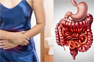 Kodėl pučia pilvą? Gydytojas įvardijo dažniausias priežastis ir sprendimo būdus