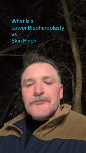 Lower eyelid blepharoplasty vs a skin pinch 👁️ These two are often confused—but they do very different things, and that difference matters more than most people realize. A lower eyelid blepharoplasty is designed to correct the root cause of under-eye aging: • Bulging or herniated fat • Muscle laxity • Poor eyelid support • Hollowing or contour irregularities A skin pinch, on the other hand, only removes a small amount of excess skin. It does not reposition fat, tighten muscle, or restore struct