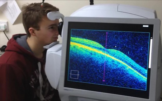 【中英双字】【OCT介绍及举例】What is OCT Scanning(Optical Coherence Tomography)