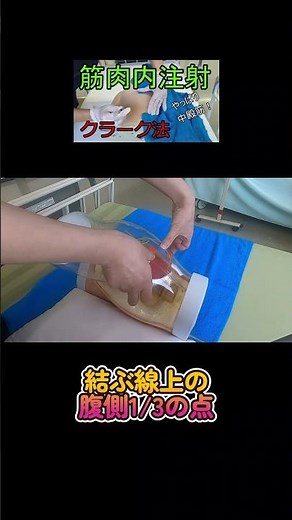 [Identifying Clark's Point] This is one method of intramuscular injection into the gluteus medius...
