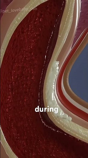 What Happens During Shockwave Therapy For Peyronies Disease ?(3danimation) #medical3danimation