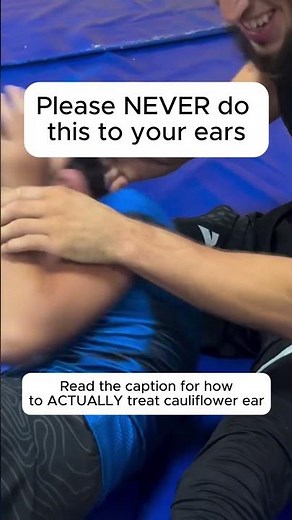 This Is NOT How You Fix Cauliflower Ear… Here’s Why 👇👂💥 #mma #ufc