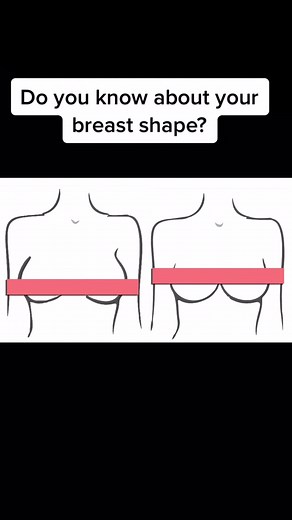 Understanding Your Breast Shape and Bra Size Calculator