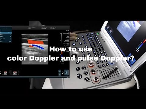 How to use color Doppler and pulse Doppler on ultrasound？