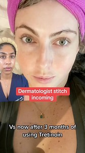 Noticing dark patches on your upper lip, cheeks or forehead? You may have a pigmentary skin condition called melasma. Here’s what causes it and what you need to know to help fade its appearance. #melasma #melasmatreatment #hyperpigmentation #foryoupage Thank you to the beautiful @physio_fitty for sharing your skin journey. | Dr. Neera