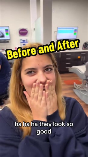 Before and After Braces Transformation Showcase