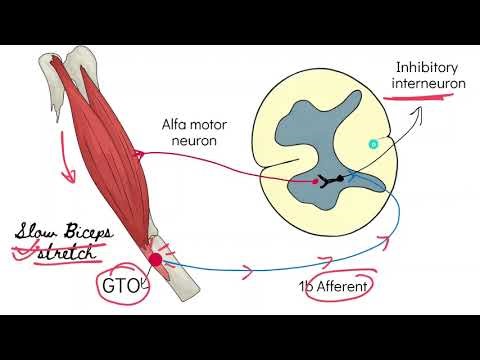 Elbow Flexor Spasticity in Hemiplegia: How to Assess and Treat elbow